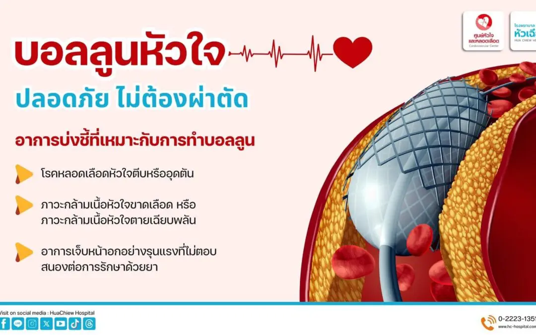 ทำบอลลูนหัวใจ ปลอดภัย ไม่ต้องผ่าตัด